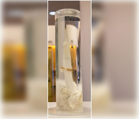 Είστε φιλότεχνοι ή γίδια;