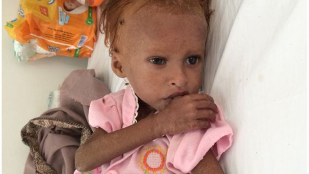 Πόλεμος στην Υεμένη