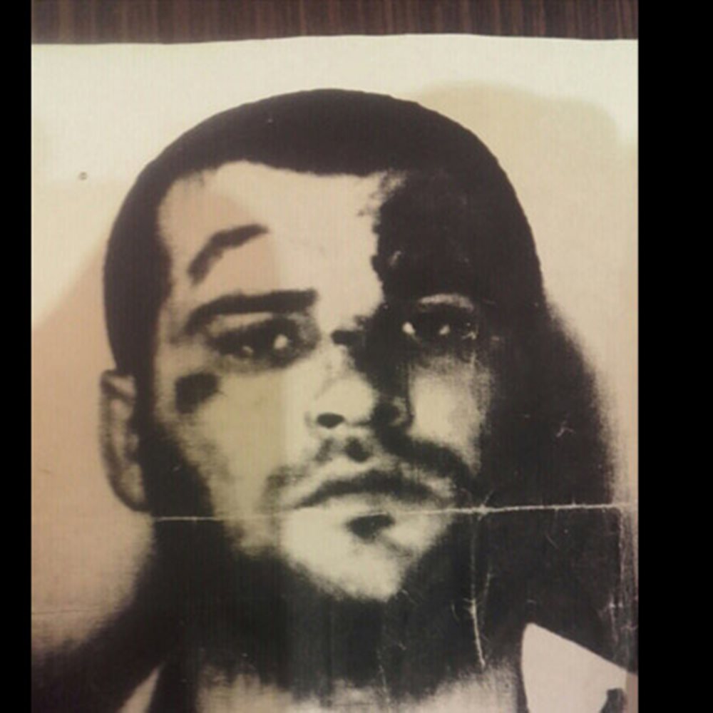 Συνελήφθη Αλβανός για επίθεση με βιτριόλι – Εξετάζεται σύνδεση με την Κούνεβα (εικόνα)