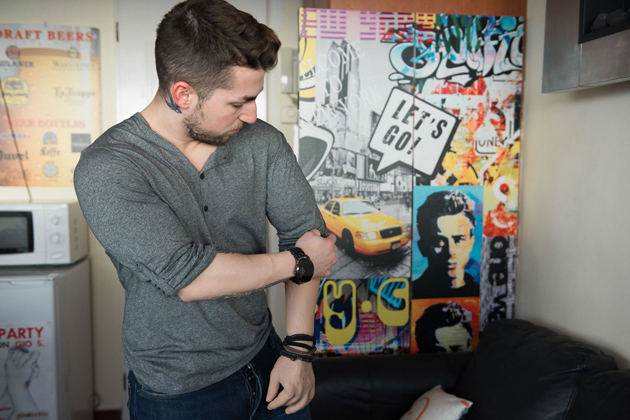 Η περιπέτεια ενός ακρωτηριασμού, Ο Γιώργος έχασε το χέρι του και έγινε ο 4ος στον κόσμο που δοκίμασε μια πρωτοποριακή επέμβαση από Έλληνα γιατρό