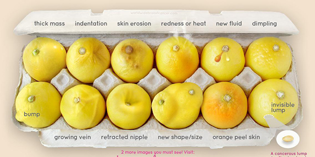 Αυτά τα 12 λεμόνια σώζουν ζωές γυναικών Αυτά τα 12 λεμόνια σώζουν ζωές γυναικών