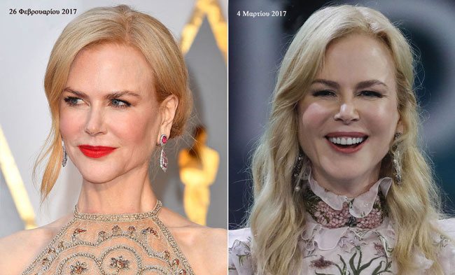 Νικόλ Κίντμαν