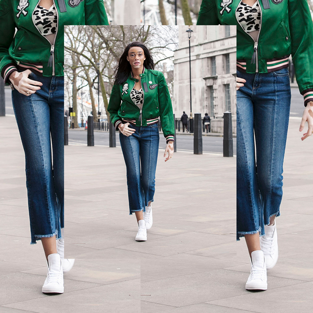 H Converse και η Winnie Harlow φέρνουν στο προσκήνιο τη Μόδα H Converse και η Winnie Harlow φέρνουν στο προσκήνιο τη Μόδα