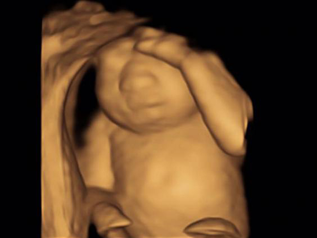 Κέρι και Ρόις Γιανγκ 