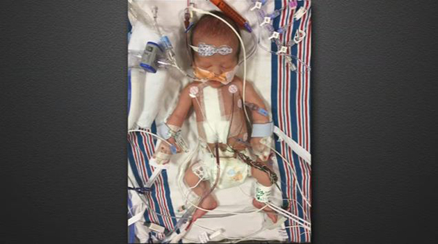 Τζίμι Κίμελ