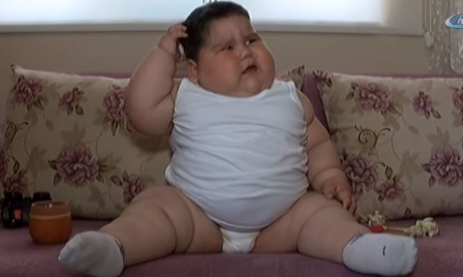 Υπέρβαρο μωρό Υπέρβαρο μωρό