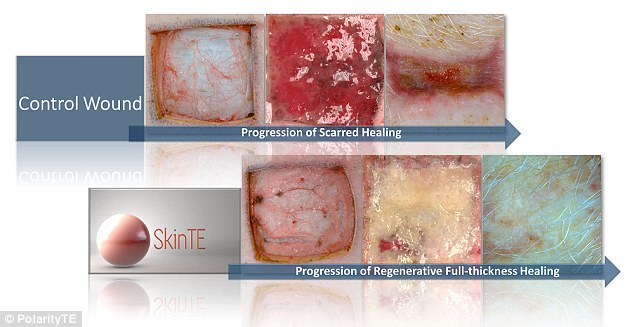 Επιστήμονες στις ΗΠΑ αναγέννησαν δέρμα και τρίχες σε χοίρους με εγκαύματα