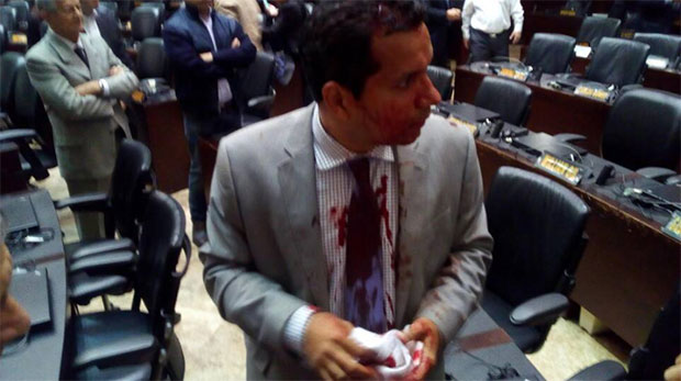 Οπαδοί του Μαδούρο ξυλοκόπησαν βουλευτές της αντιπολίτευσης Οπαδοί του Μαδούρο ξυλοκόπησαν βουλευτές της αντιπολίτευσης