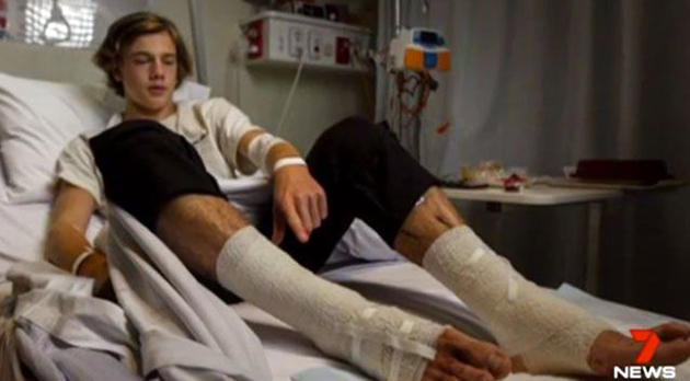 Αιμοβόρες «ψείρες της θάλασσας» κατέφαγαν τα πόδια 16χρονου