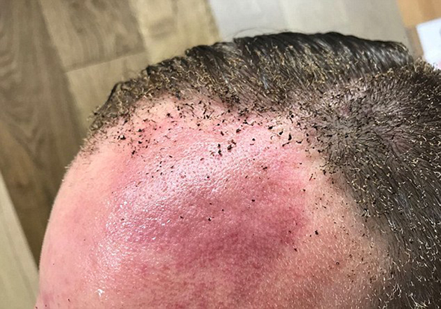 Τρόμος στο Λονδίνο. Έκρηξη σε σταθμό του μετρό 