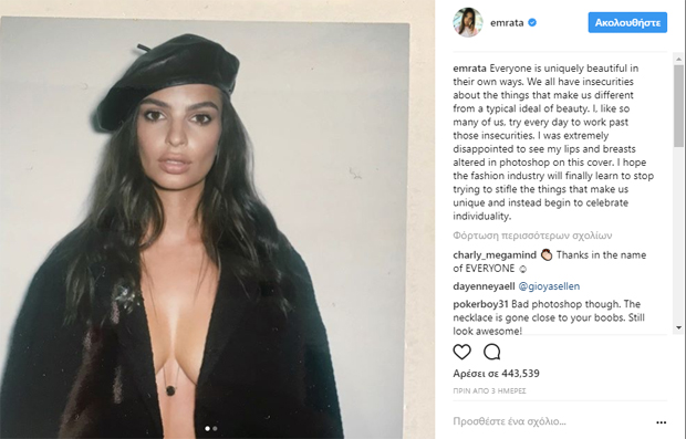 Ντροπή τους! Μου μίκρυναν το στήθος και τα χείλη Ντροπή τους! Μου μίκρυναν το στήθος και τα χείλη