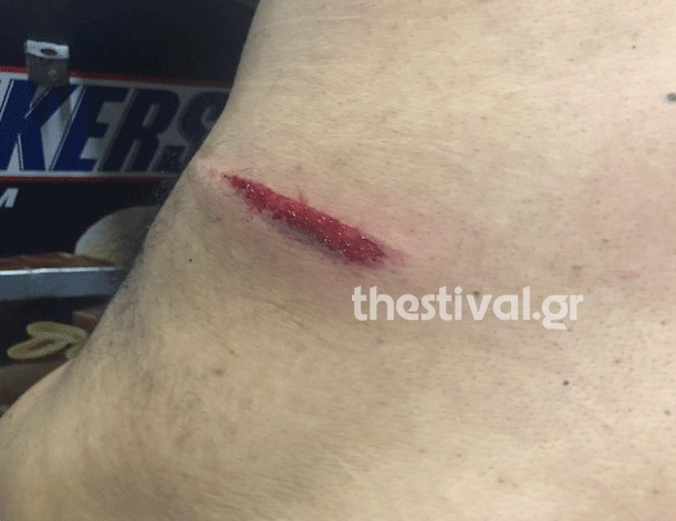 Συμπλοκή αλλοδαπών στη Θεσσαλονίκη